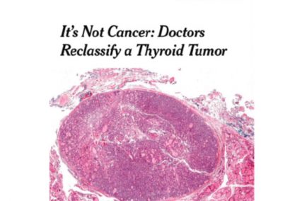Nueva clasificación de tumores tiroideos , Endocrine Practice  September 2017, Vol. 23, No. 9, pp. 1153-1158,  depertaron gran interés y comentarios siendo difundidas  en “The New York Times”